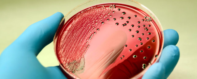 A gloved hand holds an agar plate containing Salmonella colonies.