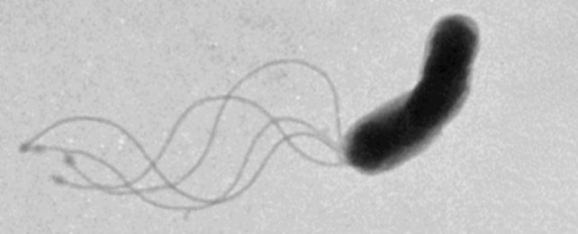 Greyscale bacteria cell with stringy flagella sticking out of one end.