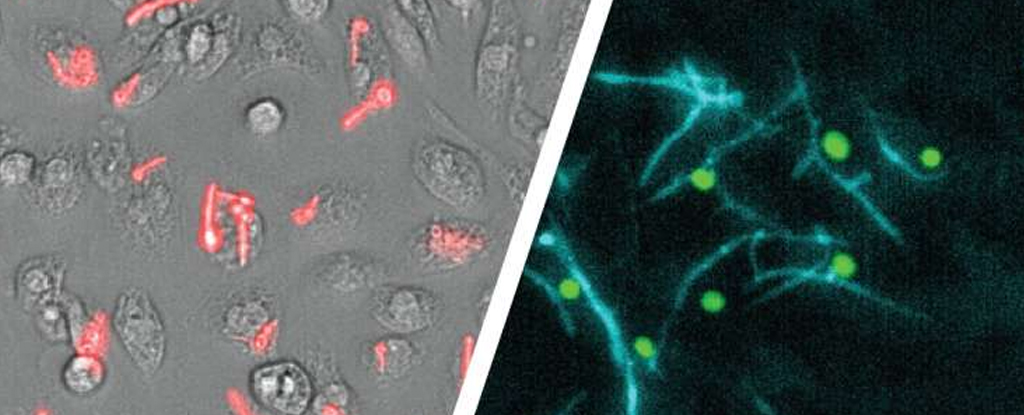 This Common Fungus Grows a Poisonous ‘Sword’ to Free Itself From Immune Cells