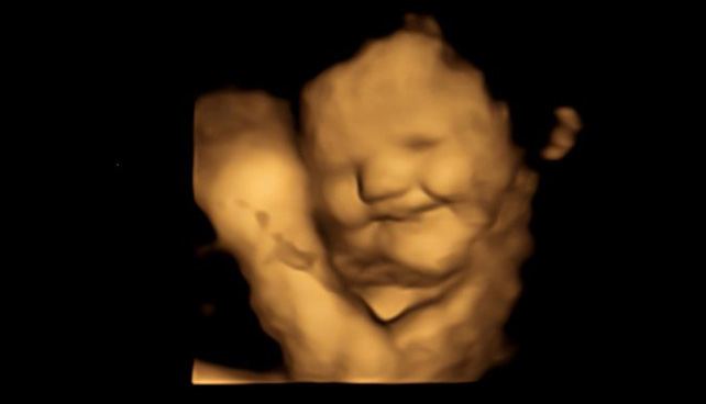 Bir fetüs, havuç tadına 'gülerek surat' tepkisi verir.