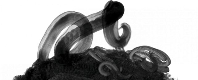 Whipworm Under Microscope