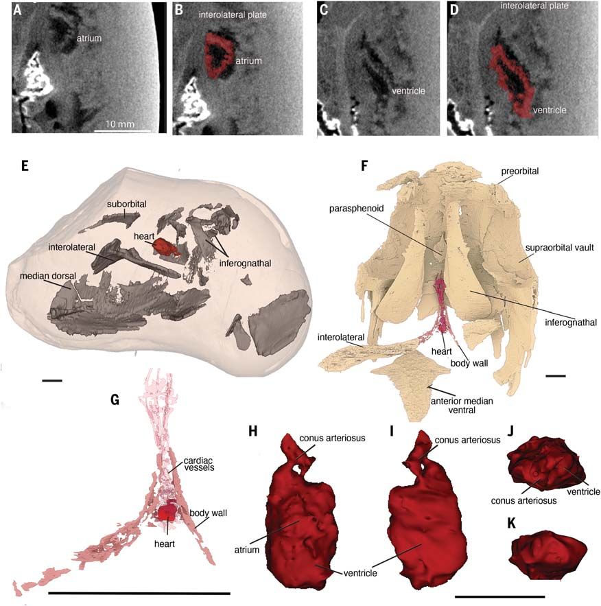 images and diagram showing fine structures observed on the arthrodire heart