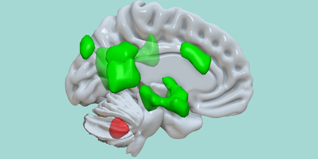 An illustration of a gray brain, with some areas colored green and another smaller area colored red.