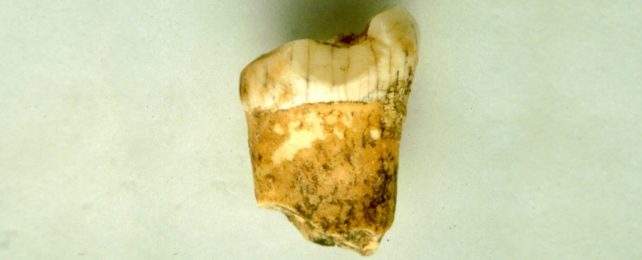 Ancient Neanderthal Molar