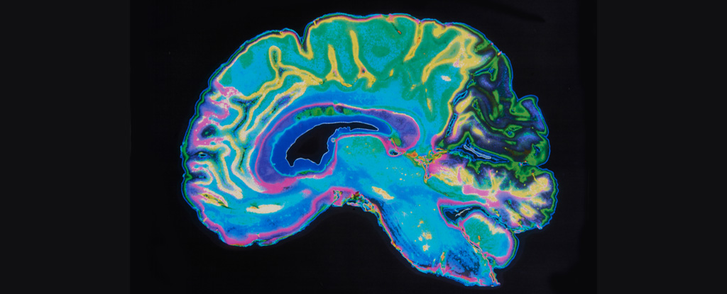 新的研究表明，小脑具有我们甚至不知道的功能：ScienceAlert