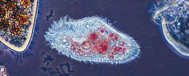 Stained Euplotes cell under microscope.