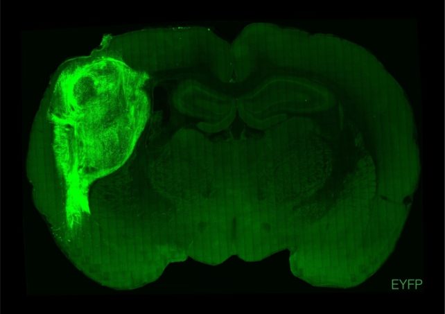 Rat Brain With Human Brain Organoid