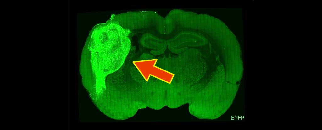 Scientists Spliced Human Brain Tissue Into The Brains of Baby Rats