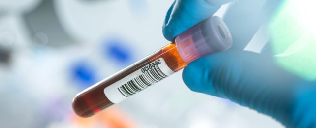 Blood Vial Held By Gloved Fingers