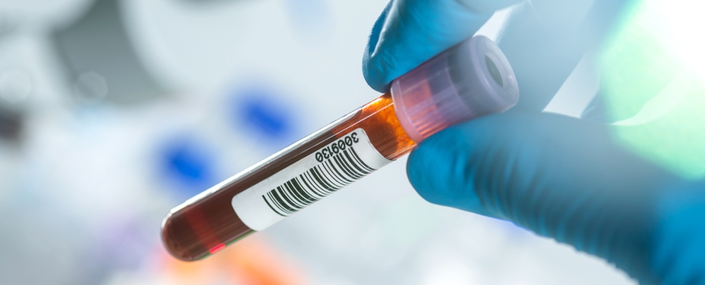 This Single Blood Test Can Detect Multiple Kinds of Cancer Early