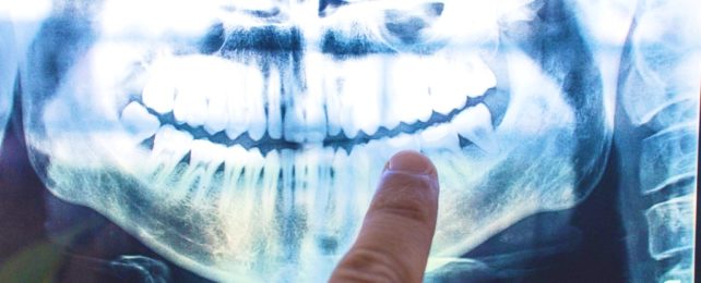 Finger Points At Mouth Xray