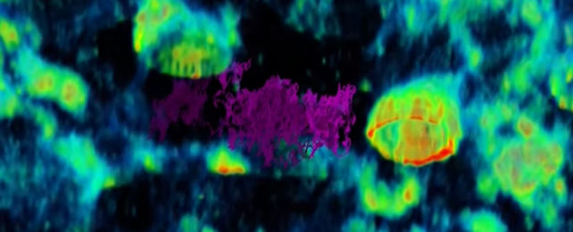 Microscopic virus tracking