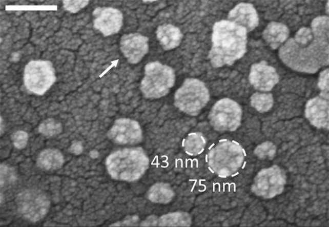 Exosomes