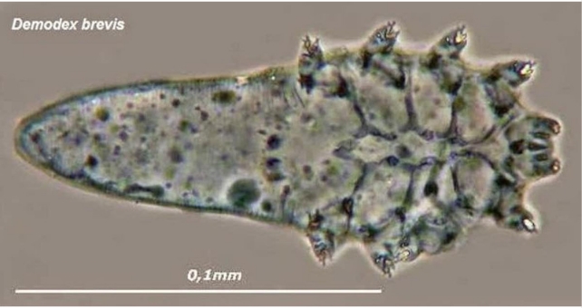 Close up of Demodex brevis showing mouthparts used ot eat oils and skin cells off our faces