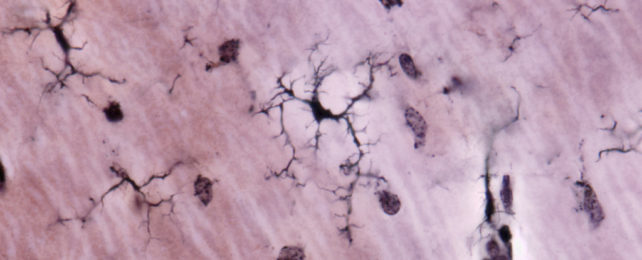 High resolution micrograph of microglia stained black in purple-colour brain tissue.