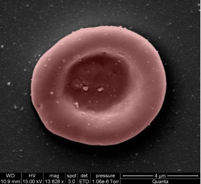 World-First Trial Transfusing Lab-Grown Red Blood Cells Begins MicroscopeImageOfASingleRedBloodCell-642x587