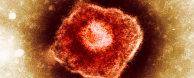 Varicella zoster virus