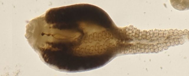 The World's Biggest Study on Parasites Has Found Something Terrible. They're Dying.