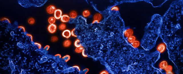 Transmission electron micrograph of HIV virus particles (shown in red) budding and replicating from infected cells (in blue)