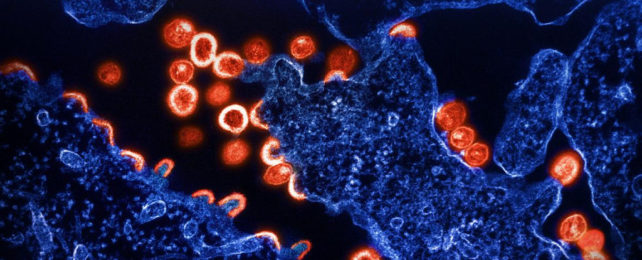 Transmission electron micrograph of HIV virus particles (shown in red) budding and replicating from infected cells (in blue)