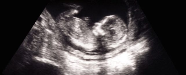 Babies May Not Be Born With a Microbiome After All, Scientists Say