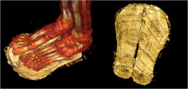 CT scan of 'Golden Boy' feet and women's shoes.