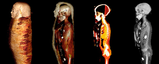 Side on view of full body CT scans of mummy.