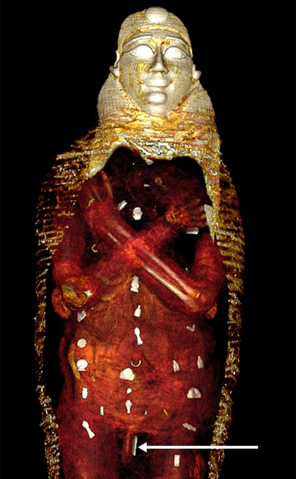 Top view of CT scan of 'Golden Boy' mummy showing the position of amulets across his chest, abdomen and hips.
