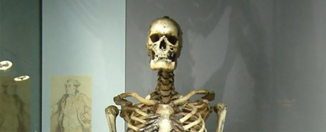 Charles Byrne skeleton