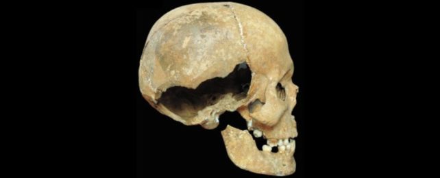 Shattered Skull Details Gruesome Final Moments of a Medieval Murder Victim
