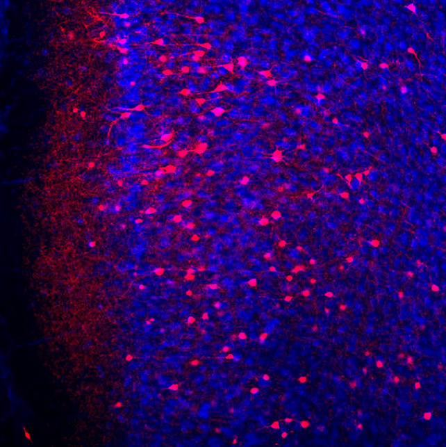 Memory neuron scan