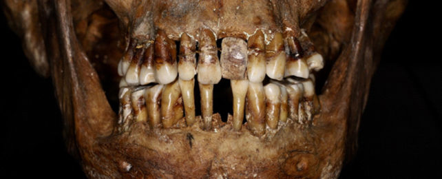 Teeth in a skull.