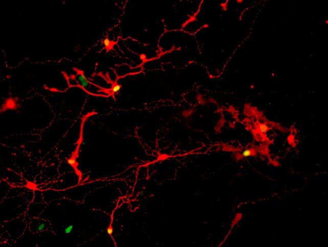 retinal neurons