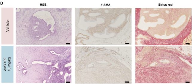 Tissue sections showing the effect of an antibody therapy on the volume of endometriosis lesions compared to control samples.