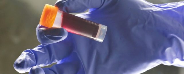Your Blood Type Affects Your Risk of Early Stroke, Scientists Find GlovedHandHoldsBloodVial-642x260