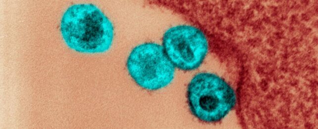 Another Person Has Been 'Cured' of HIV, Almost a Decade After Treatment