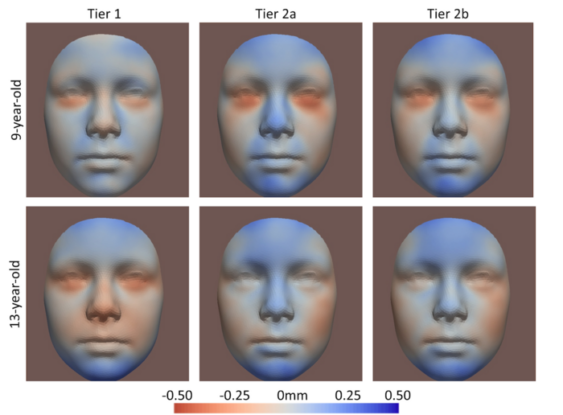 Face changes in children