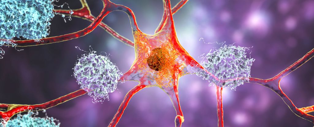 Scientists Witness For the First Time Alzheimer’s ‘Tipping Point’ in the Laboratory: ScienceAlert