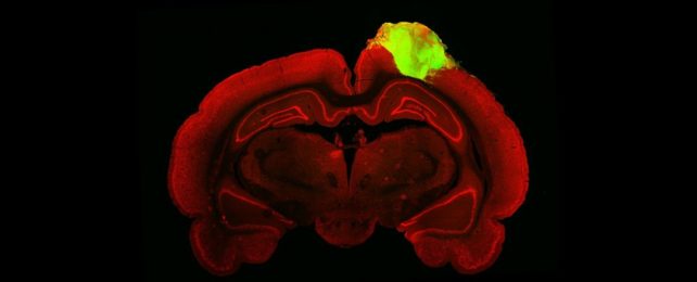 Human Brain Organoids Transplanted Into Rats Just Passed a Major Milestone