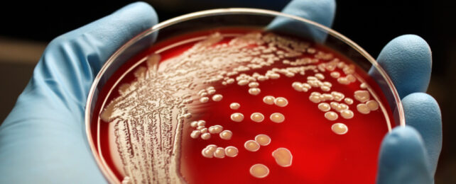 Blue-gloved hand holding a red-coloured circular agar plate with bacterial colonies growing on it.