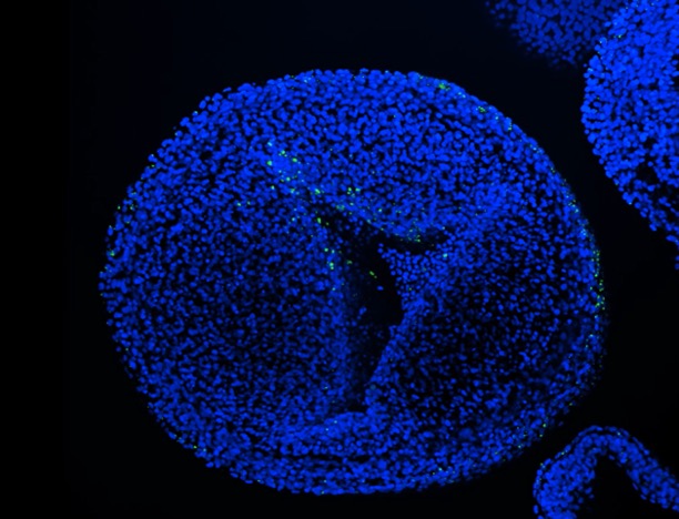 Fluorescent microscope image of cell from chicken embryo with nanoplastics attached.