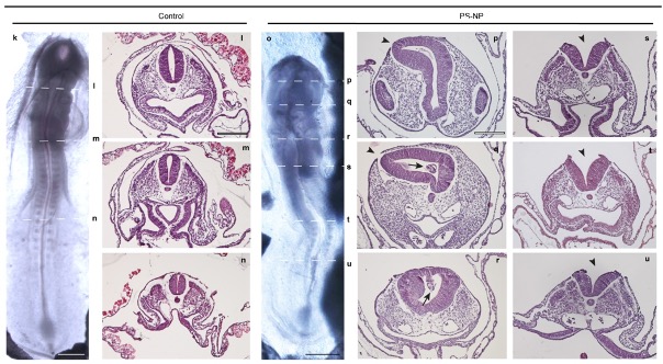 Panel of images showing neural tube defects in chicken embryos treated with nanoplastic particles, compared to untreated embryos.