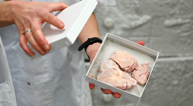 A man carries a box containing pieces of a human brain.