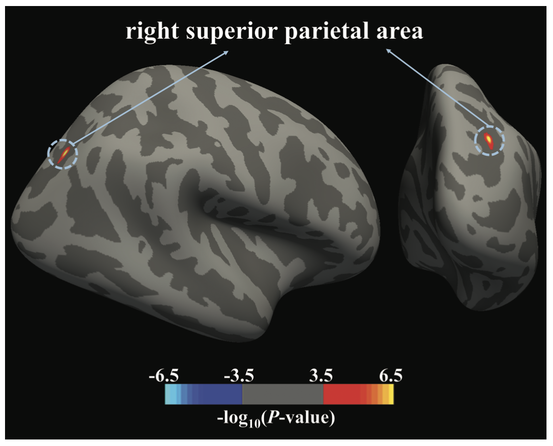 There's Something Different in The Brains of Teens With Sleep Apnea