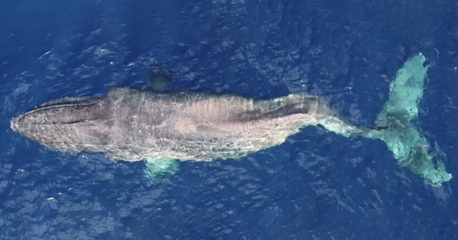 Humpback Scoliosis