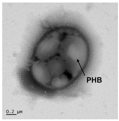 A microscope image of a single bacterium containing granules of a plastic compound, PHB.
