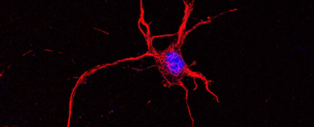 Mouse neuron