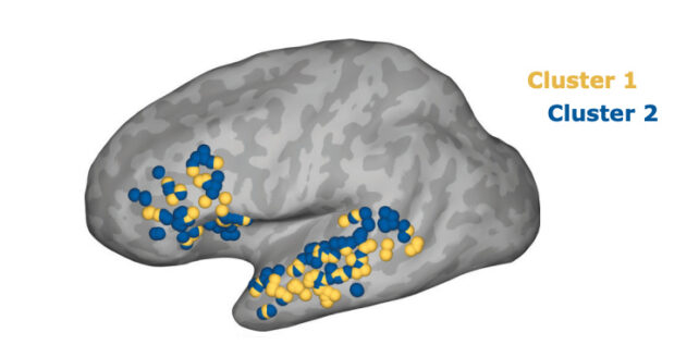 Brain with the two networks highlighted