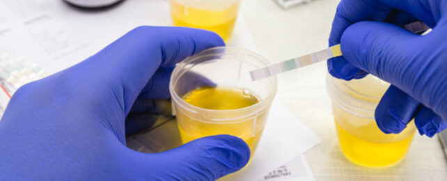 Urine being tested with a dipstick