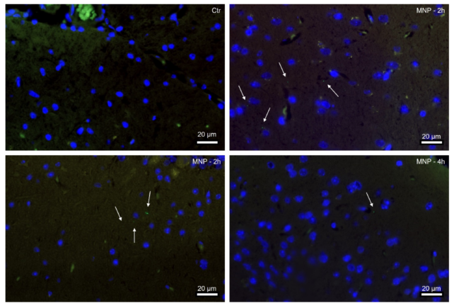 Representative immunofluorescence images of male mouse brains, with tissue sections in blue and nanoplastic particles in green. 